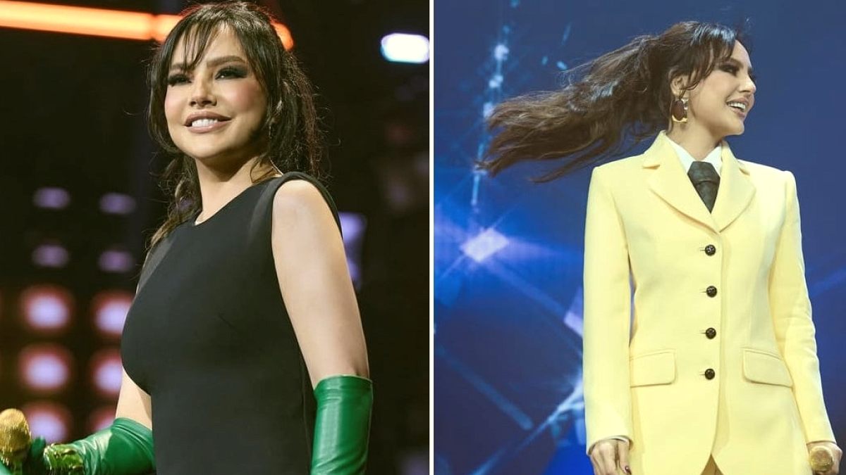 Estetik itirafının ardından Ebru Gündeş son halini ilk kez bu kadar net paylaştı