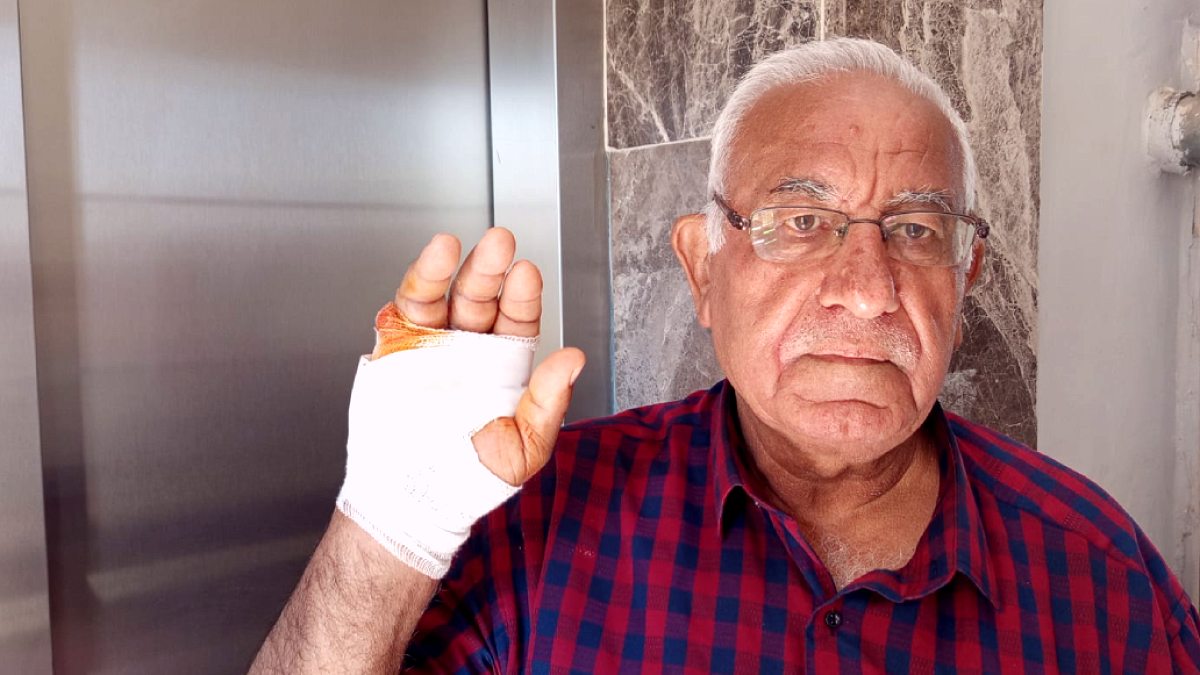 Hatay'da akılalmaz olay: Çok sevdiği komşusu parmağını ısırarak kopardı