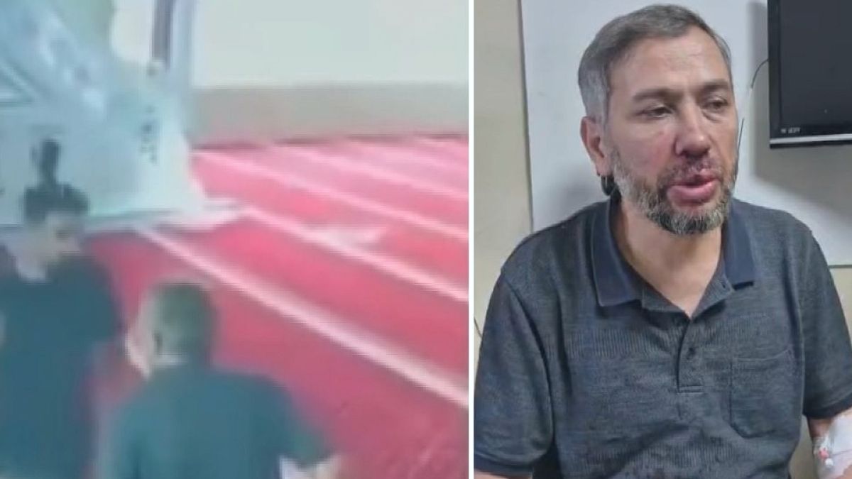 Cami İmamına Temizlik Sırasında Şok Saldırı: Yüzüne Aldığı Darbelerle Yaralandı