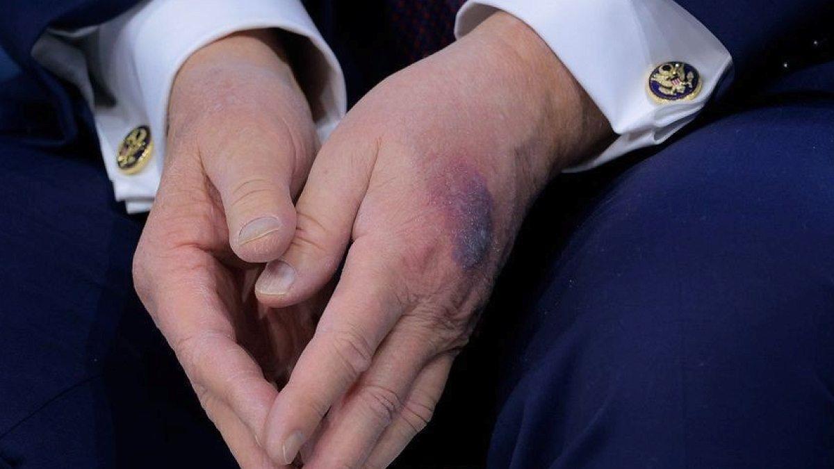 Trump'ın Sağlık Raporu Tıp Dünyasında Tartışma Yarattı