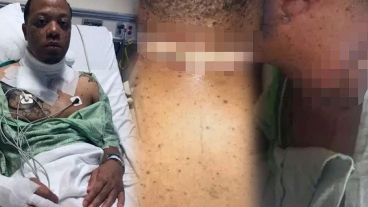 Telefon Şarj Ederken Ölümden Döndü: Kolye Hayatını Karartıyordu