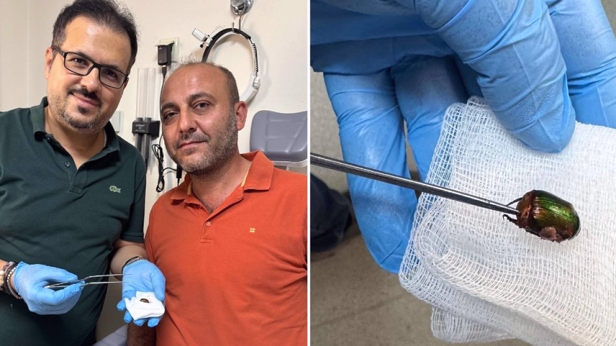 Kulağından Böcek Çıkan Çiftçi Yaşadığını Anlattı: Ağrı ve İşitme Kaybı Nedeniyle Hastaneye Başvurdu