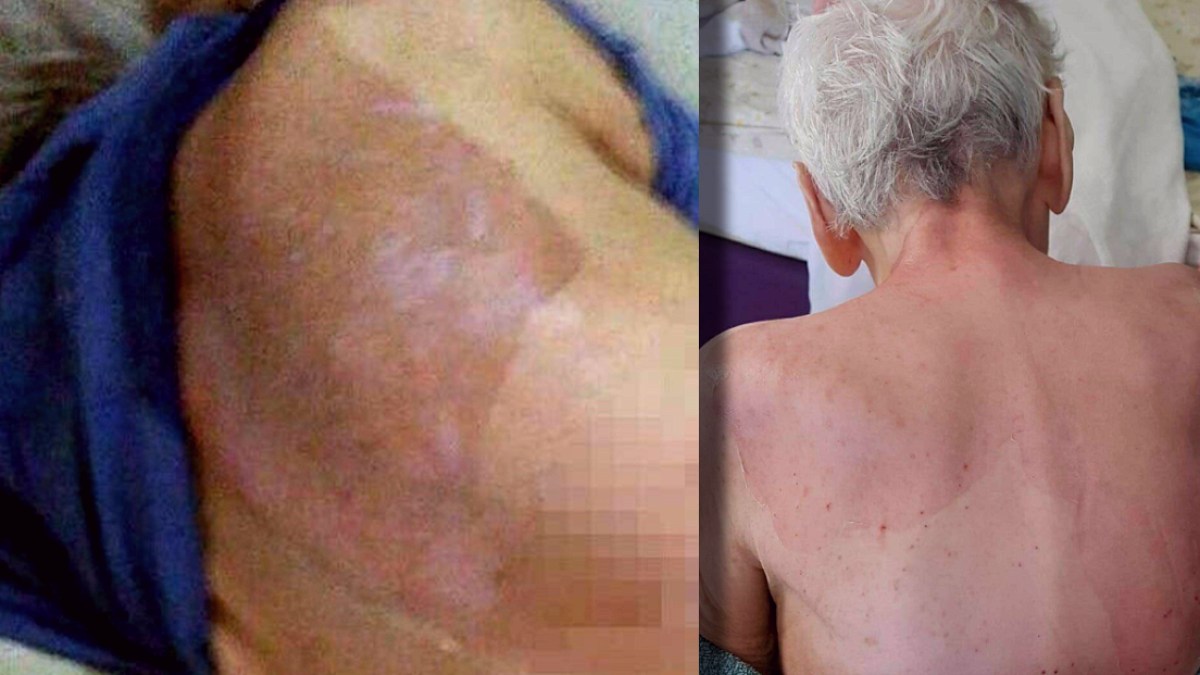 Yaşlı Bakım Evinde Ölüm: Doktorun Cezası Taksitle Ödenecek