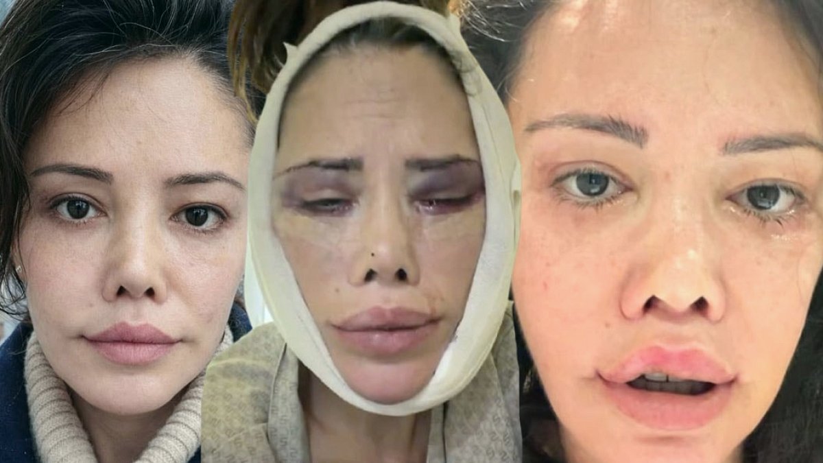 Survivor'ın Yıldızı Didem Ceran'dan Ağızları Açık Bırakan İtiraf: Hukuki Süreç Başlatıyor