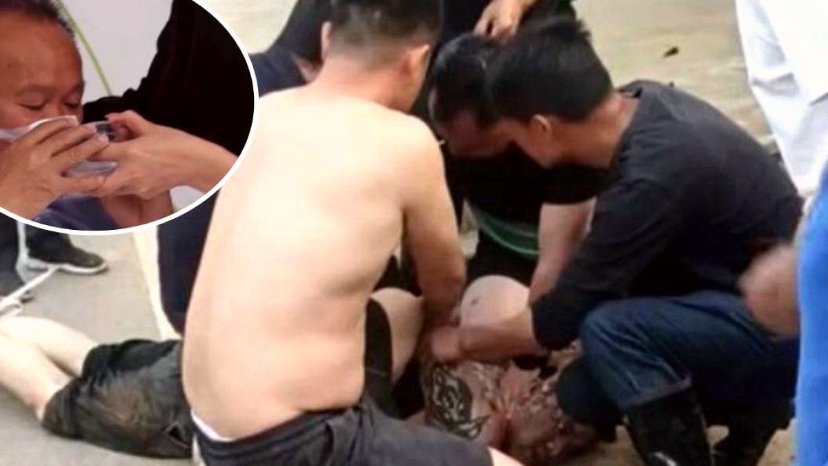 Kahraman Vatandaş Saldırganı Durdururken Burnunu Kaybetti