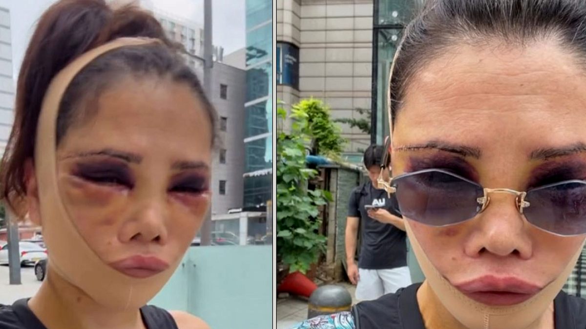 Didem Ceran'dan Estetik Sonrası Açıklama: Mücadeleci Hayat Hikayesini Anlattı