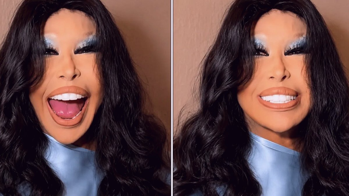 Bülent Ersoy'dan Yeni Estetik İtirafı: 'Yüzümü Lolita Gibi Yaptırdım'