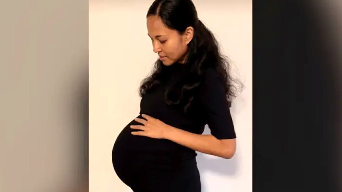 Avustralya'da 15 Milyonda Bir Görülen Olağanüstü Doğum Gerçekleşti