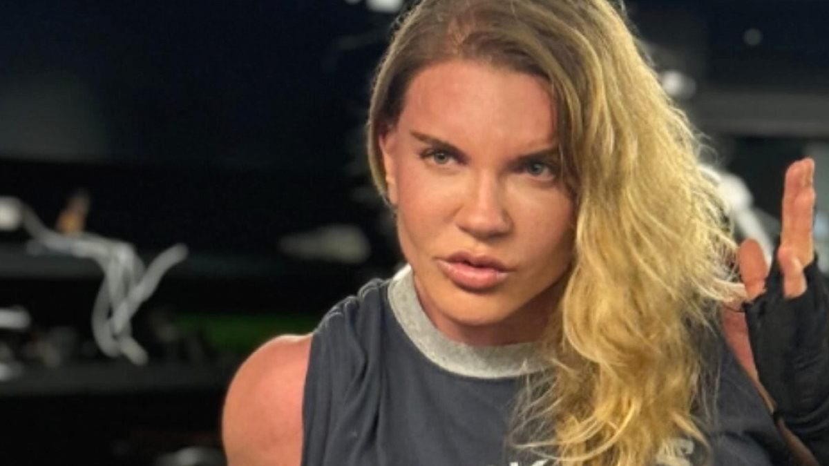 Biricik Suden'in Yeni Görüntüsü Estetik İddialarını Ateşledi