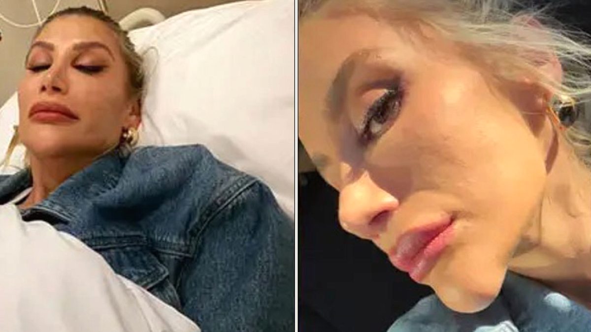 İrem Derici'nin Çene Estetiği İddialarına Şok Yanıt: Böcek Isırdı!