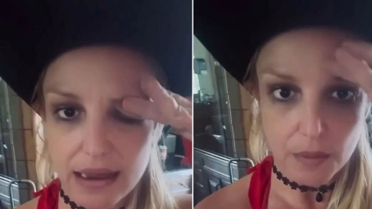 Britney Spears'tan Botoks Uyarısı: Gözüm Haftalarca Düştü