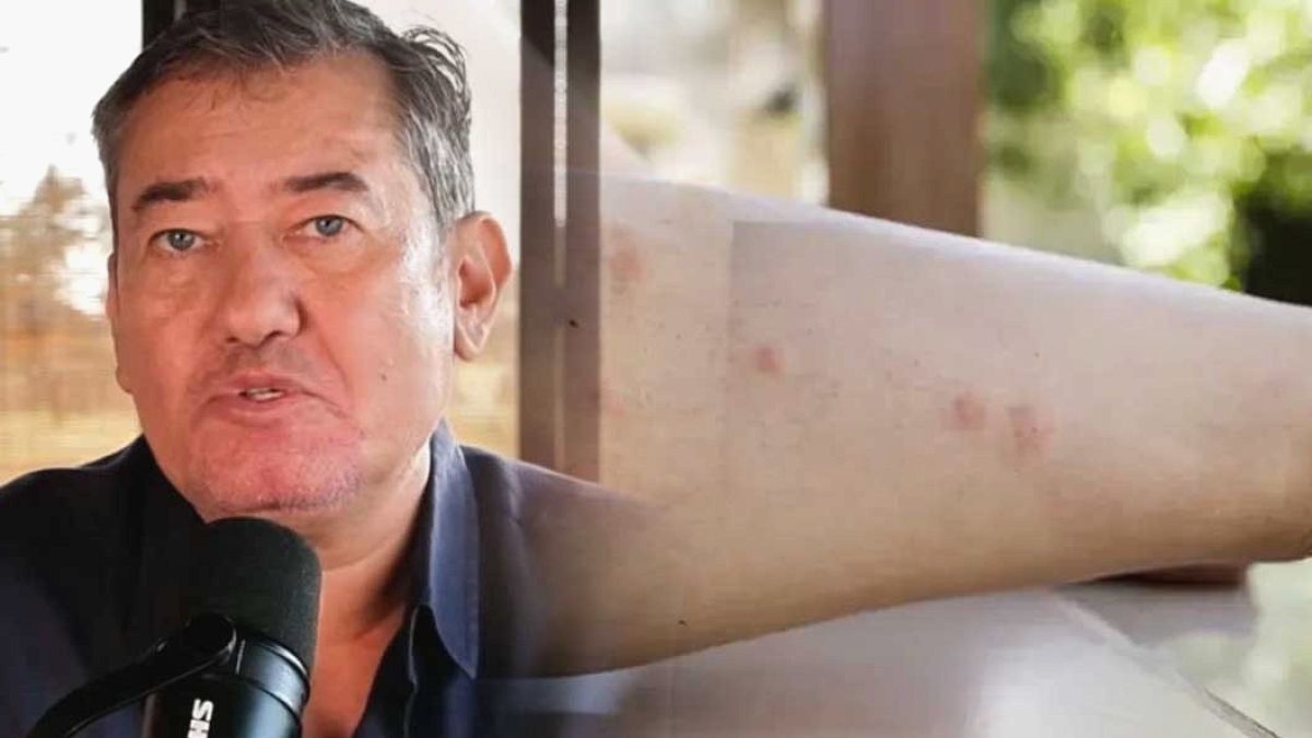 Gazeteci Serdar Akinan'ın Dang Hummasıyla Mücadelesi ve Vasiyeti