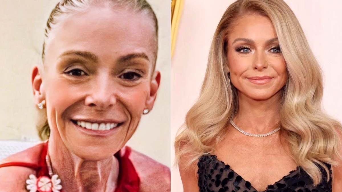 Ünlü Oyuncu Kelly Ripa'nın Diş Ameliyatı Sonrası Konuşması Yasaklandı