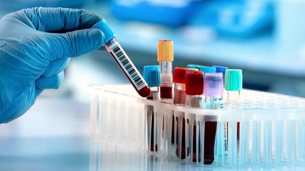 Alzheimer Teşhisinde Dönüm Noktası: Yeni Kan Testiyle Erken Tanı Mümkün