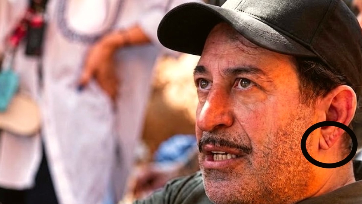 Cem Yılmaz'ın Sağlık Durumu ve Kulak Memesindeki Detay Tartışılıyor