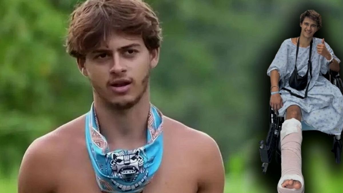 Survivor Yarışmacısı Bacağını Kaybetti, Yapımcılara 100 Milyon Dolarlık Dava Açtı