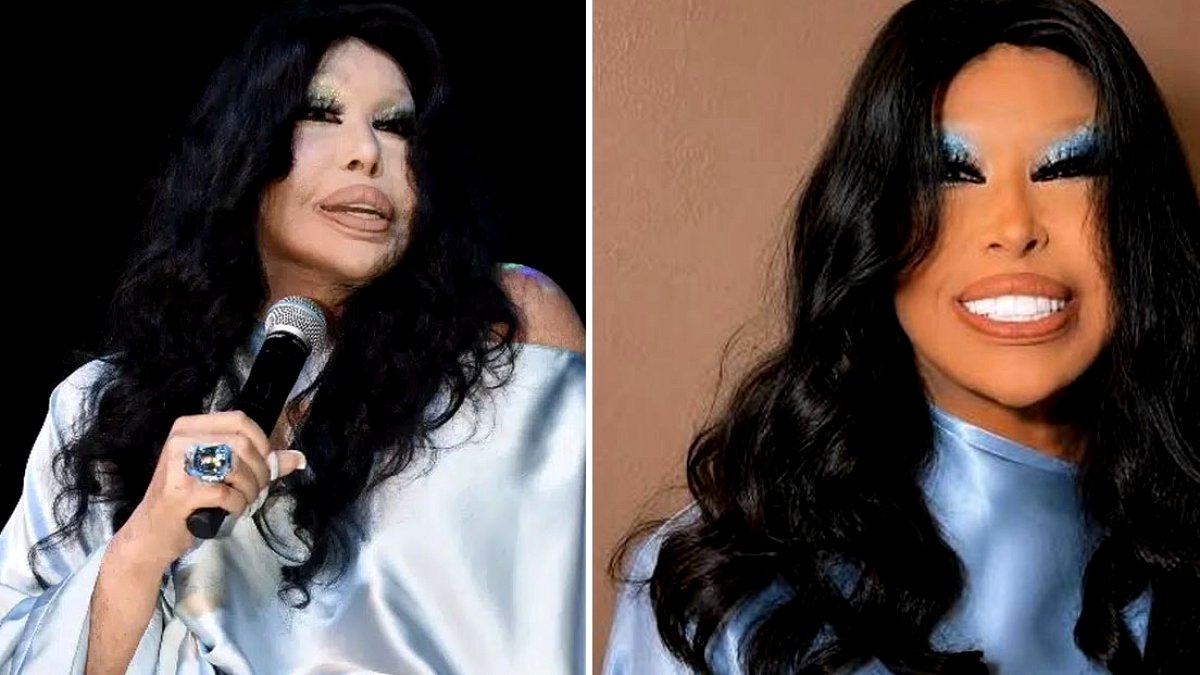 Bülent Ersoy Sahnedeki Yeni Görüntüsüyle Sosyal Medyayı Salladı