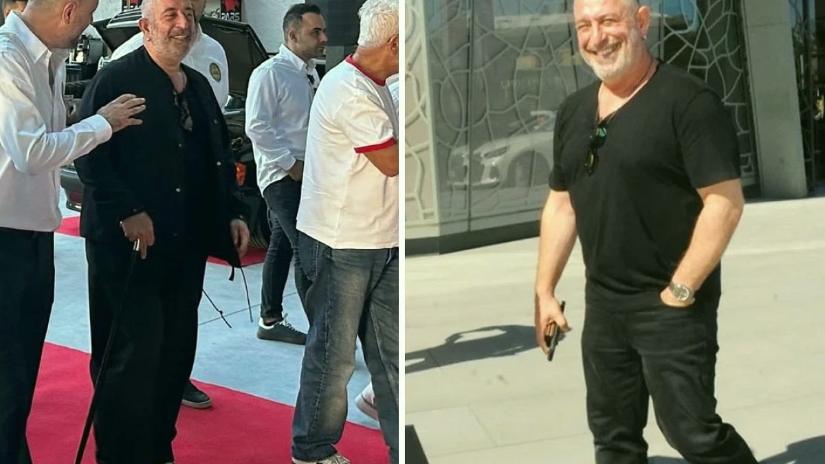 Cem Yılmaz Bastonunu Bıraktı: Muhabirlere Neşeli Pozlar Verdi