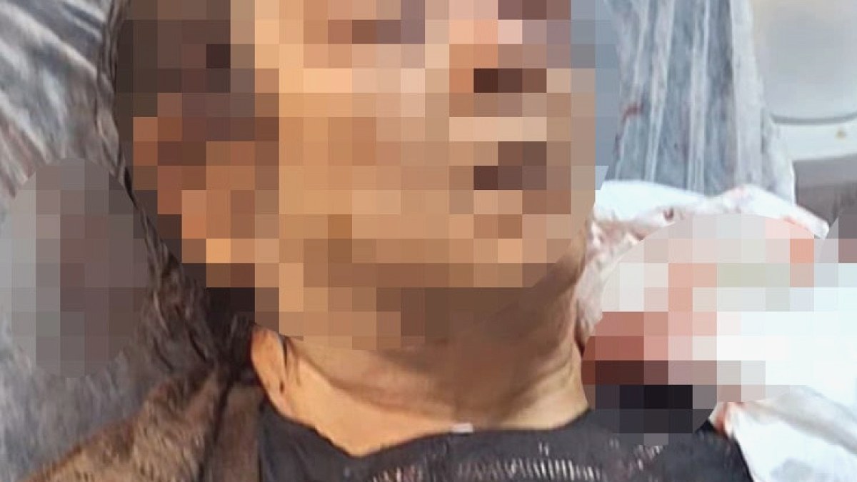 Evde Otururken Tavandan Düşen Molozlar Ağır Yaraladı
