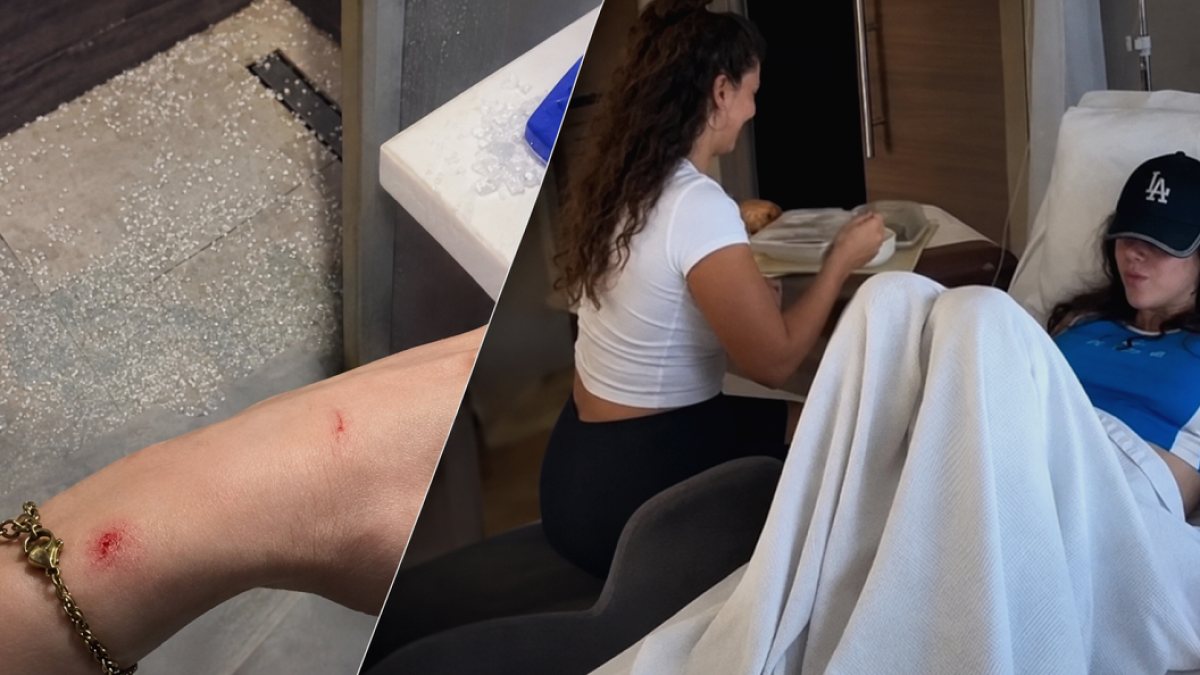 Survivor Şampiyonu Nefise Karatay Evinde Fenalaştı: Duşakabin Yüzüne Patladı